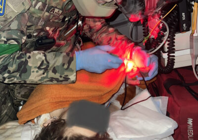 This child was critically wounded in an artillery strike on her home. Here she is being transferred from Bakhmut to a hospital. She sustained fractures to all of her limbs, a traumatic brain injury and 7 penetrating shrapnel wounds to her torso. Shortly after this photo was taken in our blacked out ambulance, we were ambushed. After fleeing the kill zone, this Childs lung had a tension pneumothorax which was dealt with. Sadly we could not save her 12 year old sister in Bakhmut and she also lost her two little playmates who were fatally injured in the same attack.